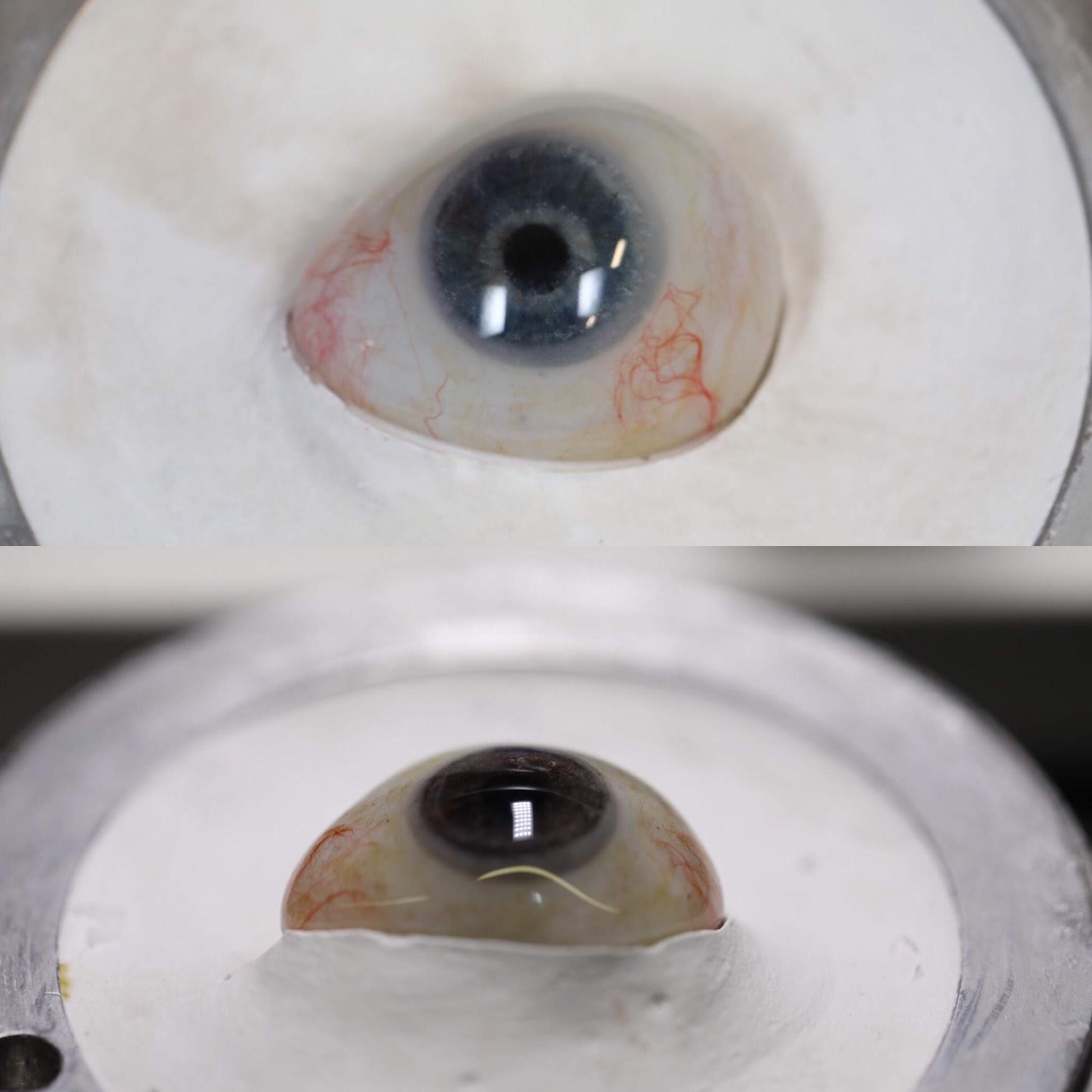 How often does a prosthetic eye need to be replaced?